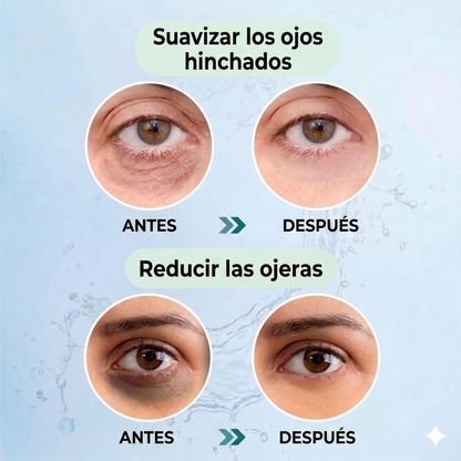 Parches Recuperación Inmediata Contorno de Ojos