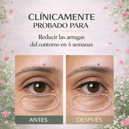 Sérum Antiojeras, Despierta tu Mirada Luminosa y Fresca . OHUOE
